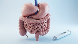 Illustration médicale réaliste d’un abdomen humain après une ablation totale du pancréas, accompagnée d’un stylo à insuline et d’un dispositif de suivi du glucose.