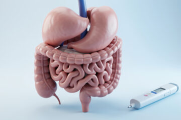 Illustration médicale réaliste d’un abdomen humain après une ablation totale du pancréas, accompagnée d’un stylo à insuline et d’un dispositif de suivi du glucose.
