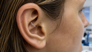 Gros plan réaliste de l’oreille d’une femme portant un discret piercing daith, dans une ambiance clinique évoquant une réflexion sur le soulagement de la migraine.